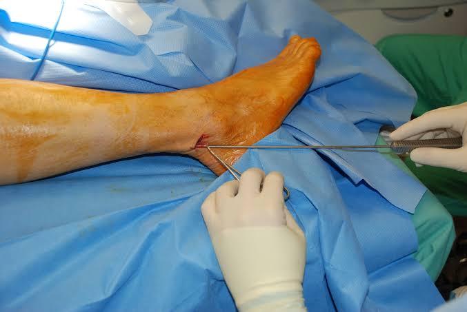 How Long Does It Take To Recover From Nerve Damage In Your Feet?